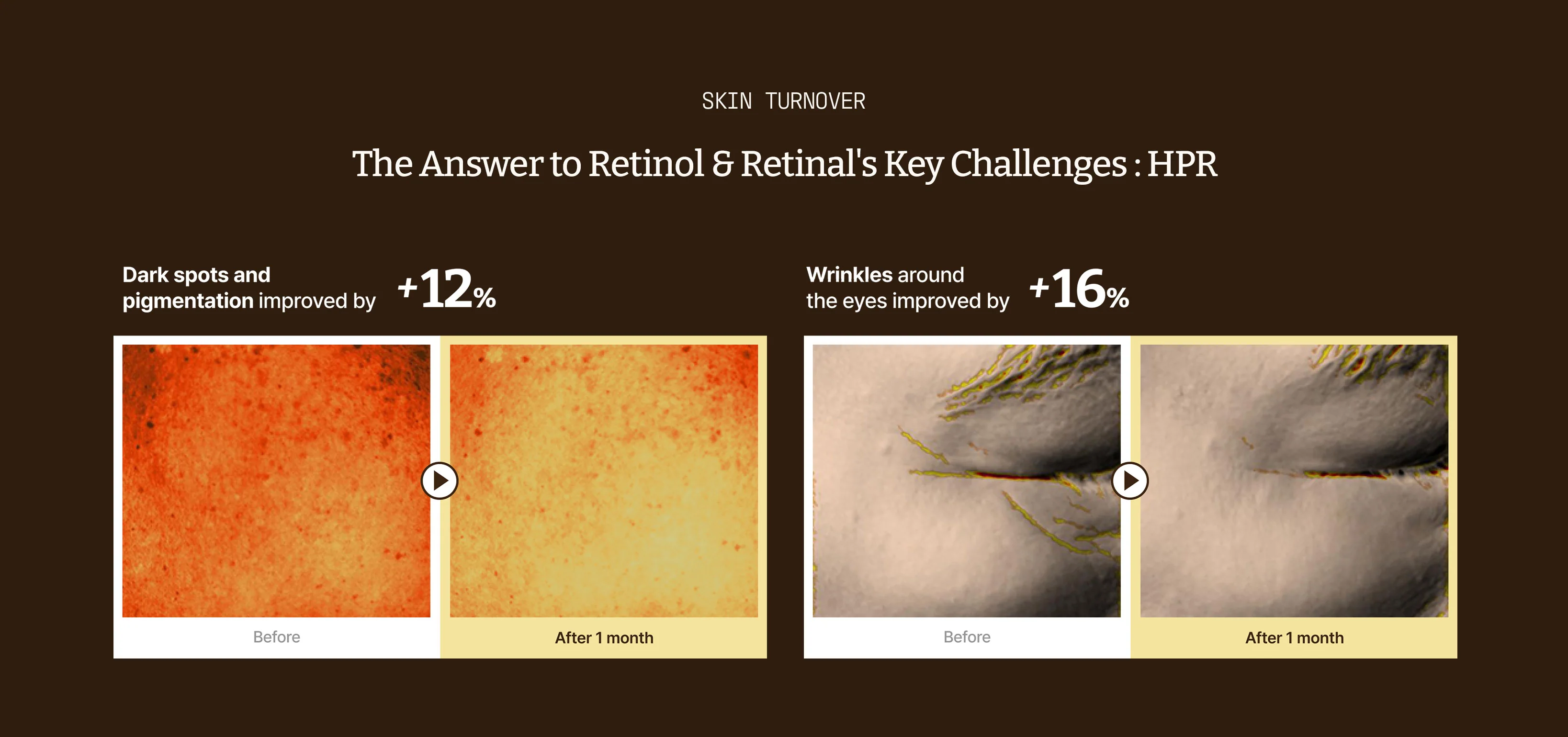 韓國藥房熱賣推介~Dr. Reju-All Advanced Retino-Mela Serum 新世代 HPR X 10% 維B3 X 傅明酸 肌膚再生淡瑕淡紋精華 - 50ml