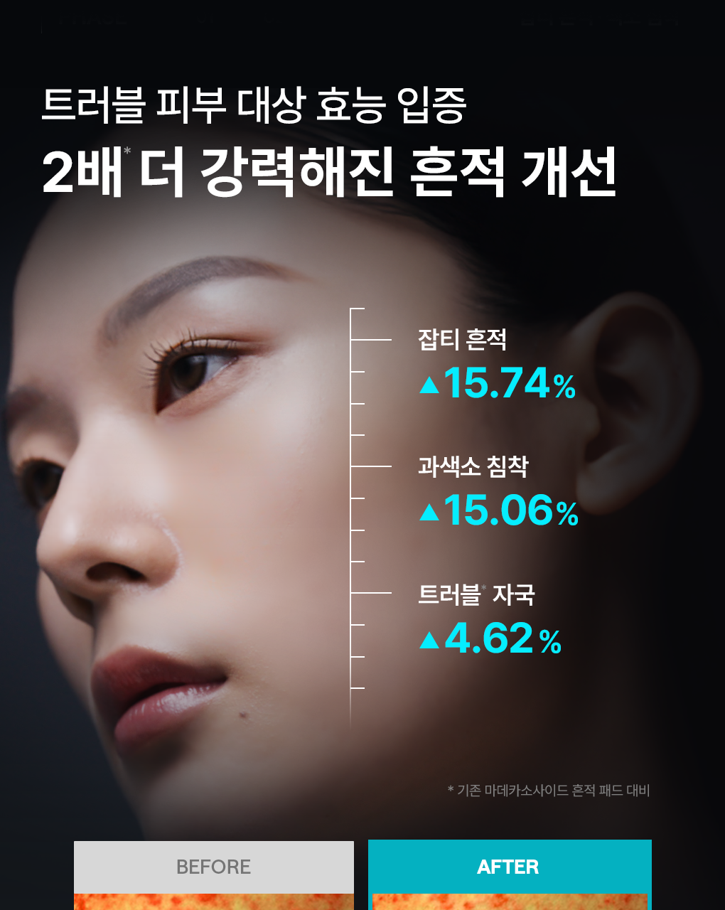 🏆OY 熱賣No.1 💡瑕疵粗糙肌～MEDIHEAL Madecassoside Blemish Pad 積雪草舒緩💡美白去印減暗沉護膚棉片 - 100片