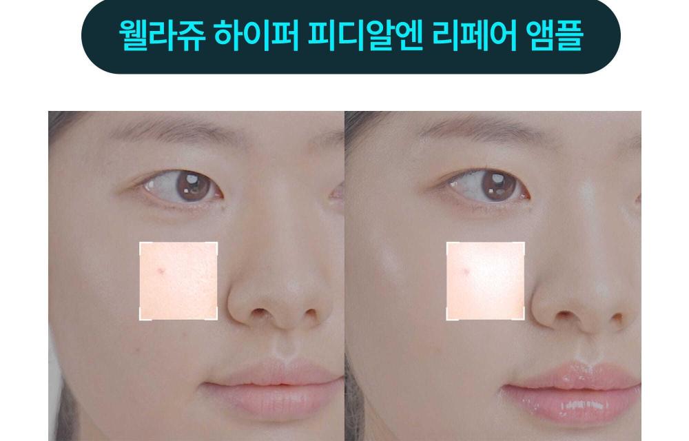 韓國 Wellage Hyper PDRN Repair Ampoule 高純度PDRN保濕彈力修護安瓶精華 - 30ml