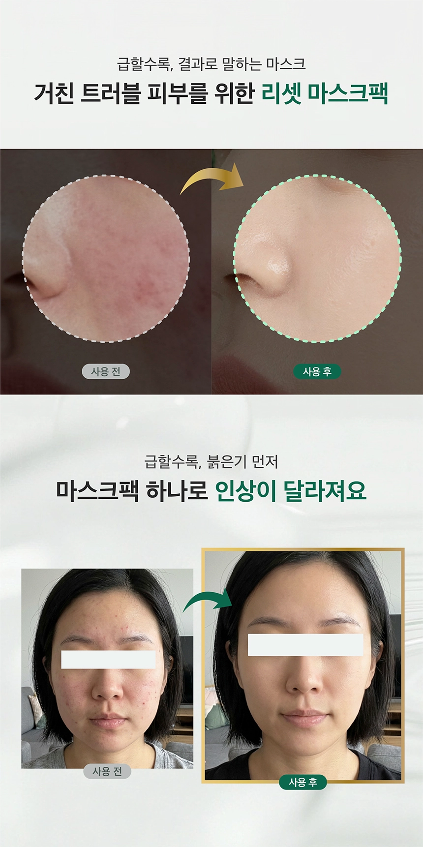 最新升級~韓國 Natural Clear Base T Calming Soothing Mask Pack Double X 有機茶樹積雪草速效舒緩鎮靜面膜 10片裝