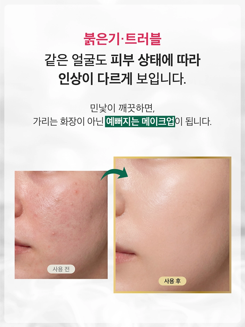 最新升級~韓國 Natural Clear Base T Calming Soothing Mask Pack Double X 有機茶樹積雪草速效舒緩鎮靜面膜 10片裝