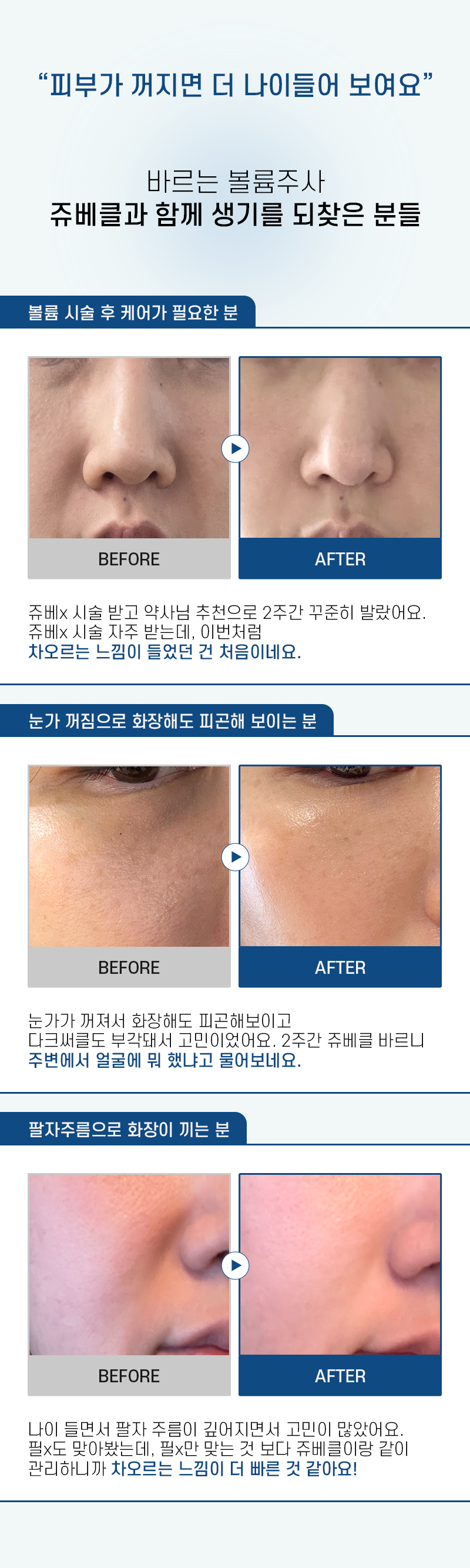 韓國藥房推介~塗抹式填充面霜~RXme Juvekle 10000+ PDLLA Fill Up Cream 醫美級高濃度塗抹型 PDLLA 填充皮膚凹陷減紋乳霜 - 30ml