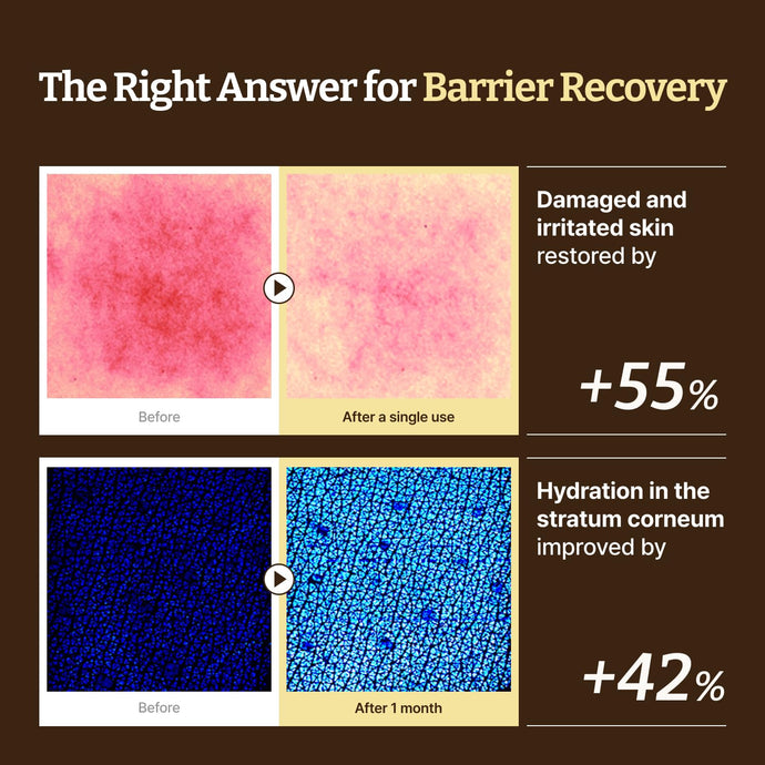 韓國藥房熱賣~Dr. Reju-All Advanced LC-Ceramide Barrier Cream 專利長鏈神經醯胺屏障修護保濕面霜 - 大容量90ml 韓國藥房熱賣~Dr. Reju-All Advanced LC-Ceramide Barrier Cream 專利長鏈神經醯胺屏障修護保濕面霜 - 大容量90ml