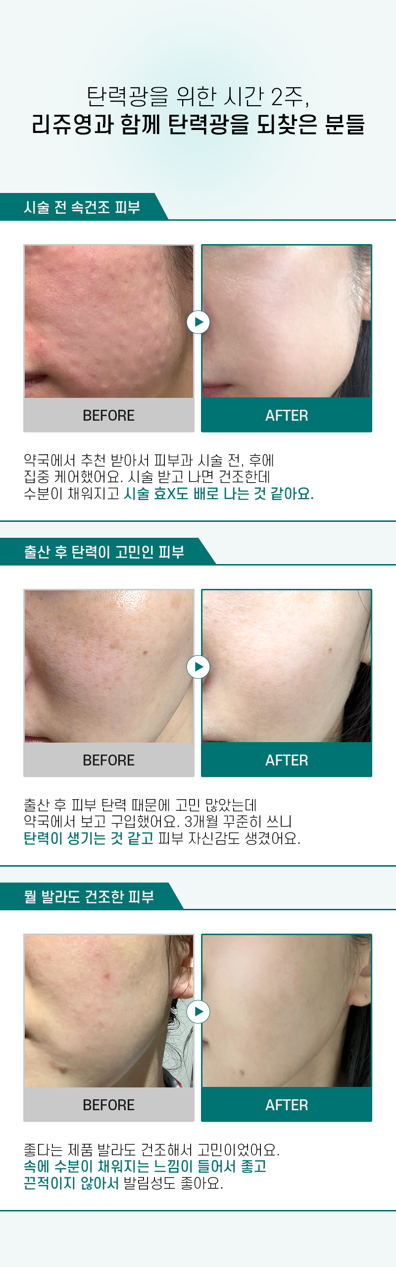 韓國藥房推介~醫美術前後 RXme Rejuyoung PDRN 10000 Deep Repair Cream 99%純度鮭魚PDRN 深層修復面霜 - 30ml