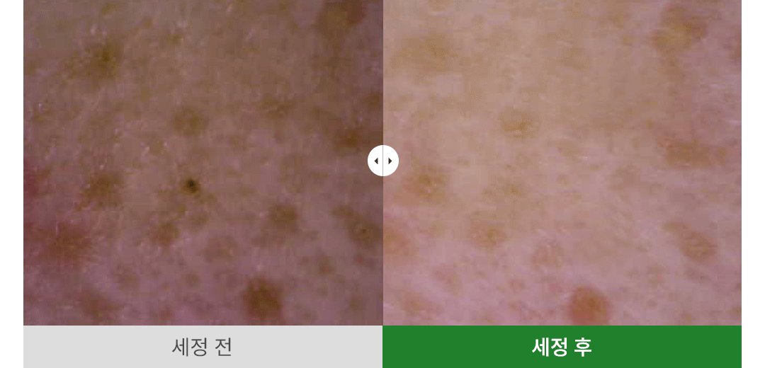 韓國 Ariul Apple Cider Deep Cleansing Oil 蘋果醋深層淨化卸妝潔面油 - 200ml