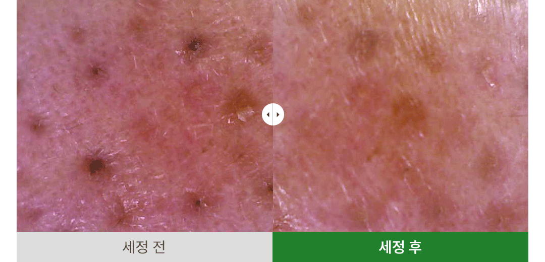 韓國 Ariul Apple Cider Deep Cleansing Oil 蘋果醋深層淨化卸妝潔面油 - 200ml