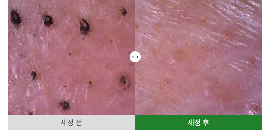 韓國 Ariul Apple Cider Deep Cleansing Oil 蘋果醋深層淨化卸妝潔面油 - 200ml