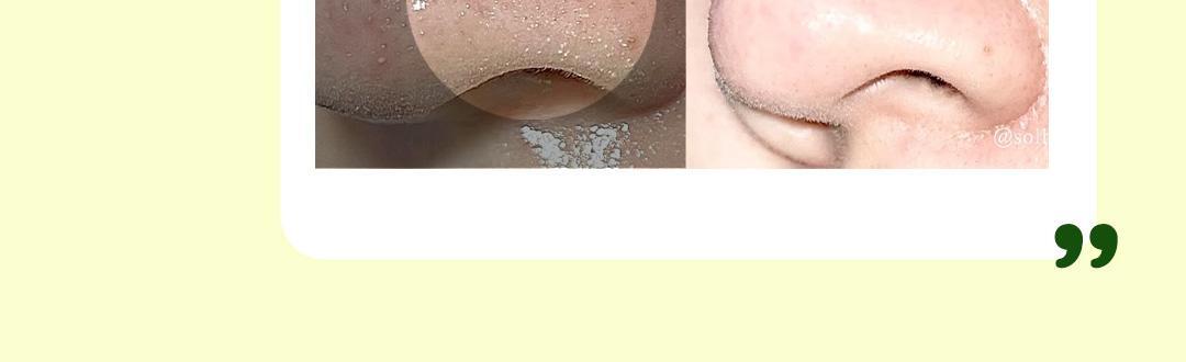 韓國 Ariul Apple Cider Deep Cleansing Oil 蘋果醋深層淨化卸妝潔面油 - 200ml