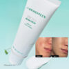 抗痘淡印~韓國 Bring Green Zinc Teca Repair Cream 鋅PCA X TECA 脂質體積雪草鎮靜修復袪痘面霜 - 80ml