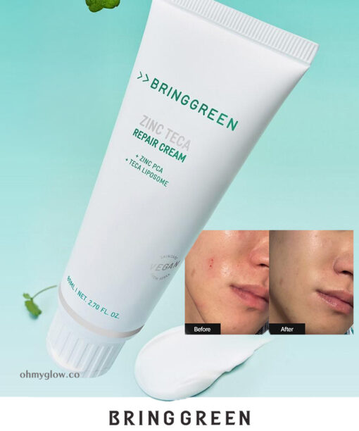 抗痘淡印~韓國 Bring Green Zinc Teca Repair Cream 鋅PCA X TECA 脂質體積雪草鎮靜修復袪痘面霜 - 80ml