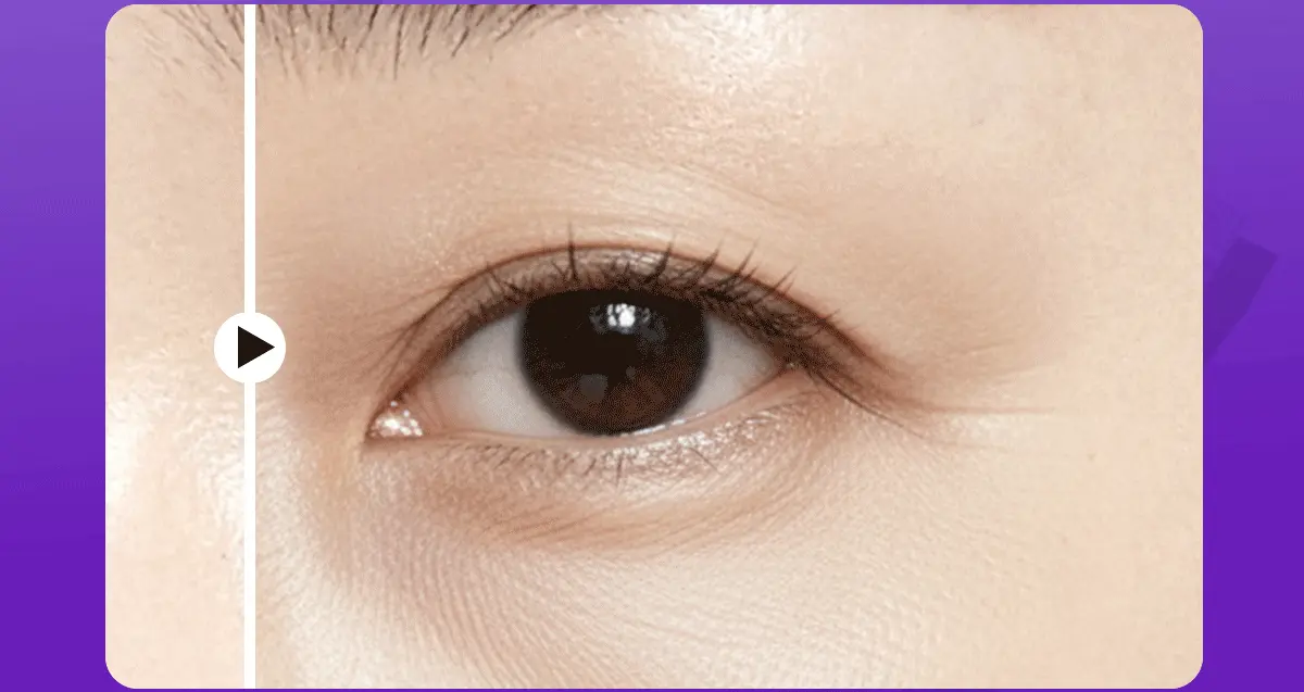 告別眼下垂～韓國 東國製藥出品 Centellian24 360° Shot PDRN lifting Eye Cream  全方位眼周拉提淡眼紋緊緻2X PDRN眼霜 - 30ml