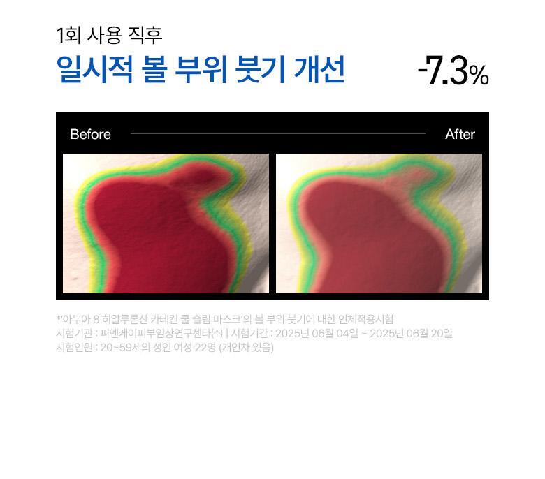 韓國 【優惠5+1 Set 5送1片】ANUA Hyaluronic Acid 8 + Catechin Cool Slim Mask 綠茶🍵兒茶素 X 8重透明質酸冰感降溫保濕鎮靜面膜