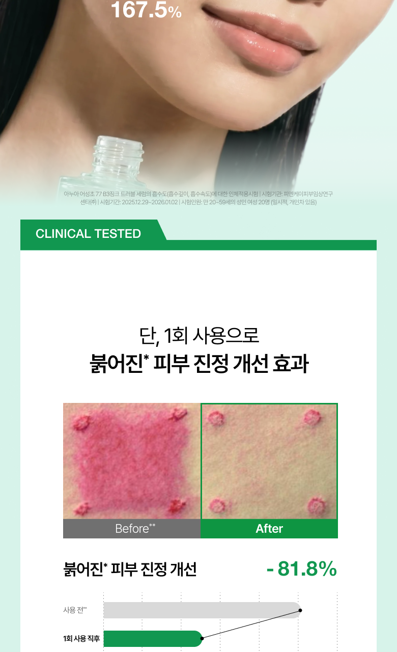 【1+1 OY優惠SET】新升級 針對痘痘肌～ANUA Heartleaf 77 + B3Zinc Soothing Serum 魚腥草X維B3鋅舒緩減紅抗痘修護精華 - 2種選擇