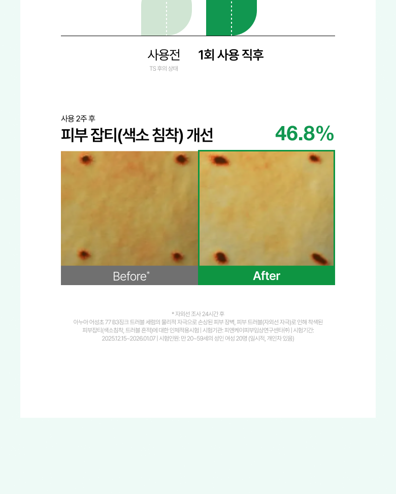 【1+1 OY優惠SET】新升級 針對痘痘肌～ANUA Heartleaf 77 + B3Zinc Soothing Serum 魚腥草X維B3鋅舒緩減紅抗痘修護精華 - 2種選擇