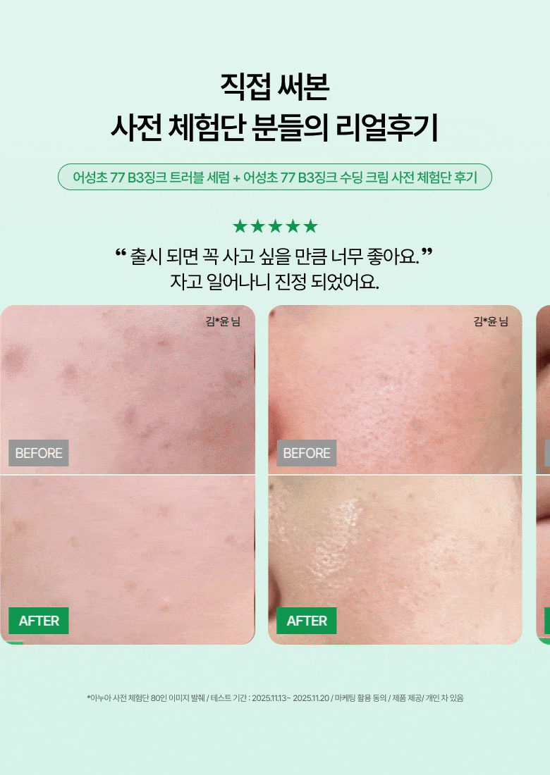 【1+1 OY優惠SET】新升級 針對痘痘肌～ANUA Heartleaf 77 + B3Zinc Soothing Serum 魚腥草X維B3鋅舒緩減紅抗痘修護精華 - 2種選擇