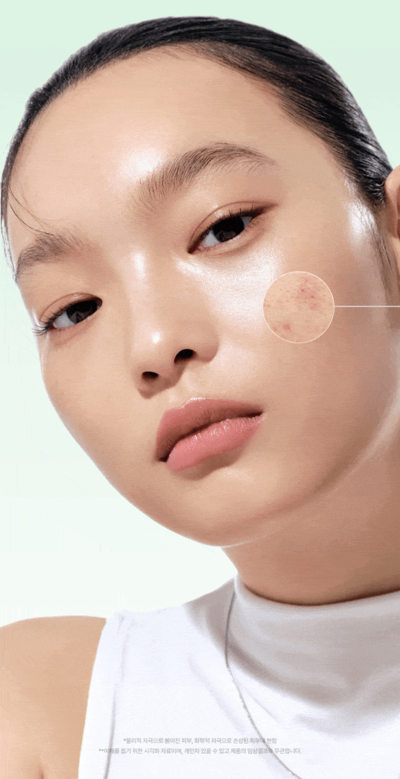 【1+1 OY優惠SET】新升級 針對痘痘肌～ANUA Heartleaf 77 + B3Zinc Soothing Serum 魚腥草X維B3鋅舒緩減紅抗痘修護精華 - 2種選擇