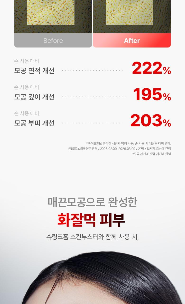 \最新升級2.0 3合1美容儀/ 限量SET送面膜～家用醫美級美容 韓國 Bioheal BOH X SHURINK Collagen Serum Set 重塑膠原彈力光澤雙效美容儀＋精華護理套裝送面膜