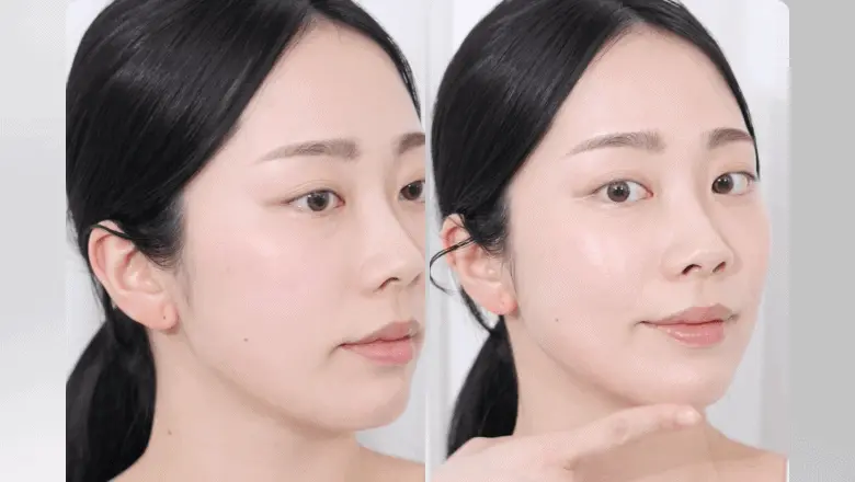 \最新升級2.0 3合1美容儀/ 限量SET送面膜～家用醫美級美容 韓國 Bioheal BOH X SHURINK Collagen Serum Set 重塑膠原彈力光澤雙效美容儀＋精華護理套裝送面膜