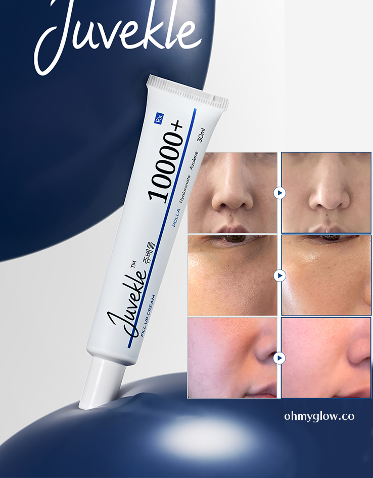 韓國藥房推介~塗抹式填充眼周凹陷/法令紋~韓國 RXme Juvekle 10000+ PDLLA Fill Up Cream 醫美級高濃度塗抹型 PDLLA 填充皮膚凹陷減紋乳霜 - 30ml 韓國藥房推介~塗抹式填充眼周凹陷/法令紋~韓國 RXme Juvekle 10000+ PDLLA Fill Up Cream 醫美級高濃度塗抹型 PDLLA 填充皮膚凹陷減紋乳霜 - 30ml