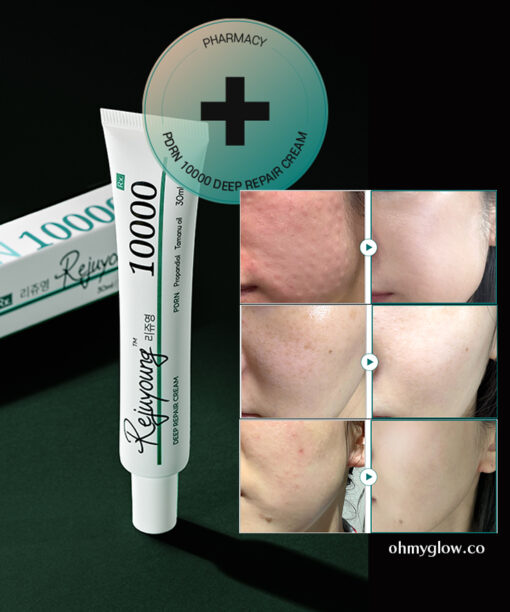 韓國藥房推介~醫美術前後 RXme Rejuyoung PDRN 10000 Deep Repair Cream 99%純度鮭魚PDRN 深層修復面霜 - 30ml