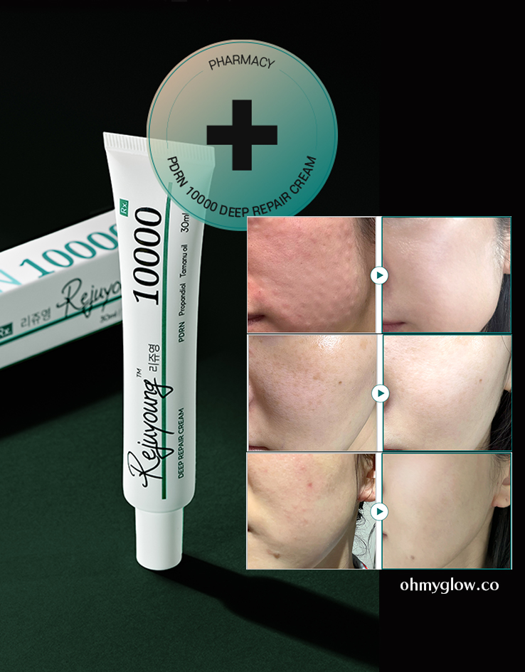 韓國藥房推介~醫美術前後 RXme Rejuyoung PDRN 10000 Deep Repair Cream 99%純度鮭魚PDRN 深層修復面霜 - 30ml 韓國藥房推介~醫美術前後 RXme Rejuyoung PDRN 10000 Deep Repair Cream 99%純度鮭魚PDRN 深層修復面霜 - 30ml