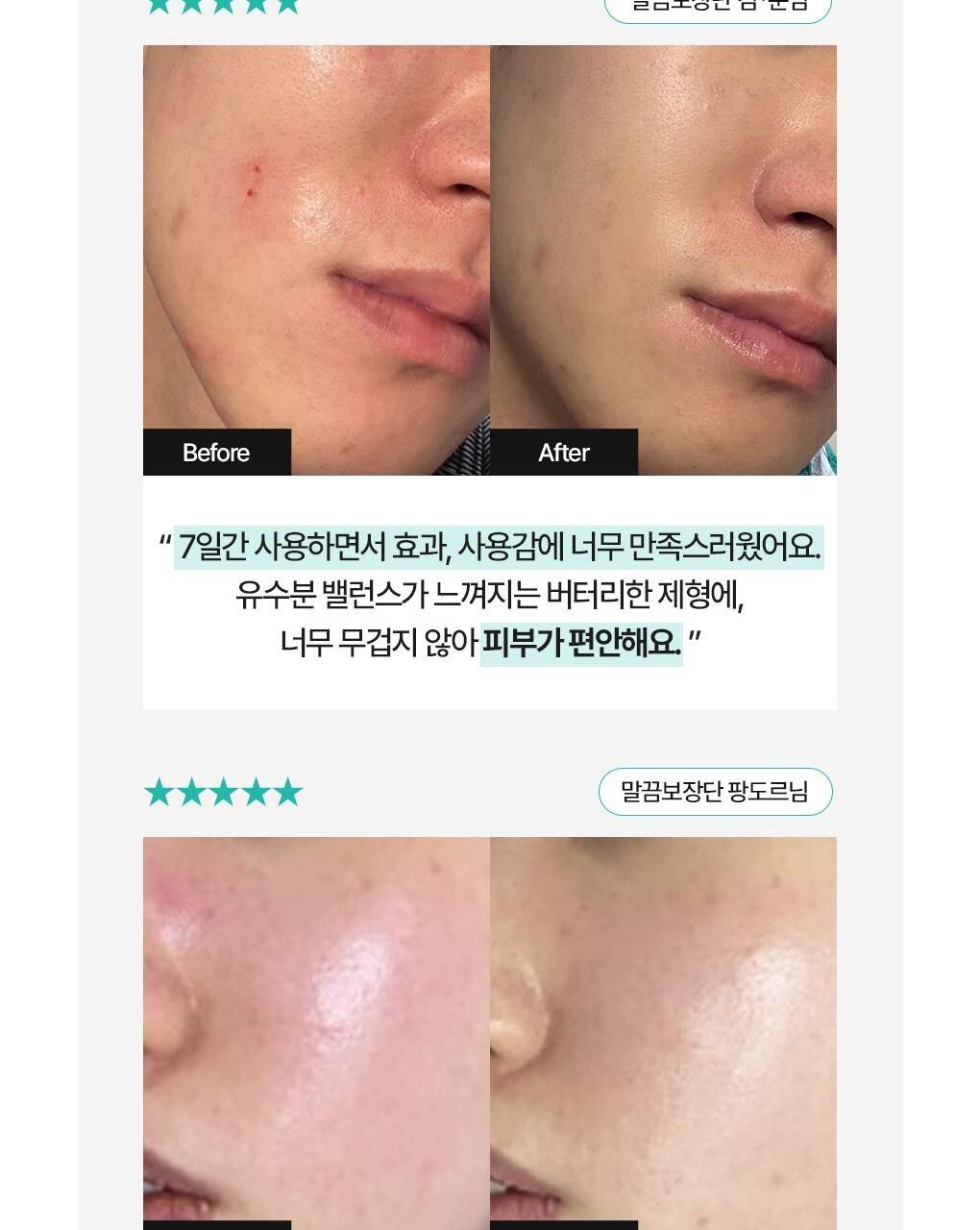 抗痘淡印~韓國 Bring Green Zinc Teca Repair Cream 鋅PCA X TECA 脂質體積雪草鎮靜修復袪痘面霜 - 80ml