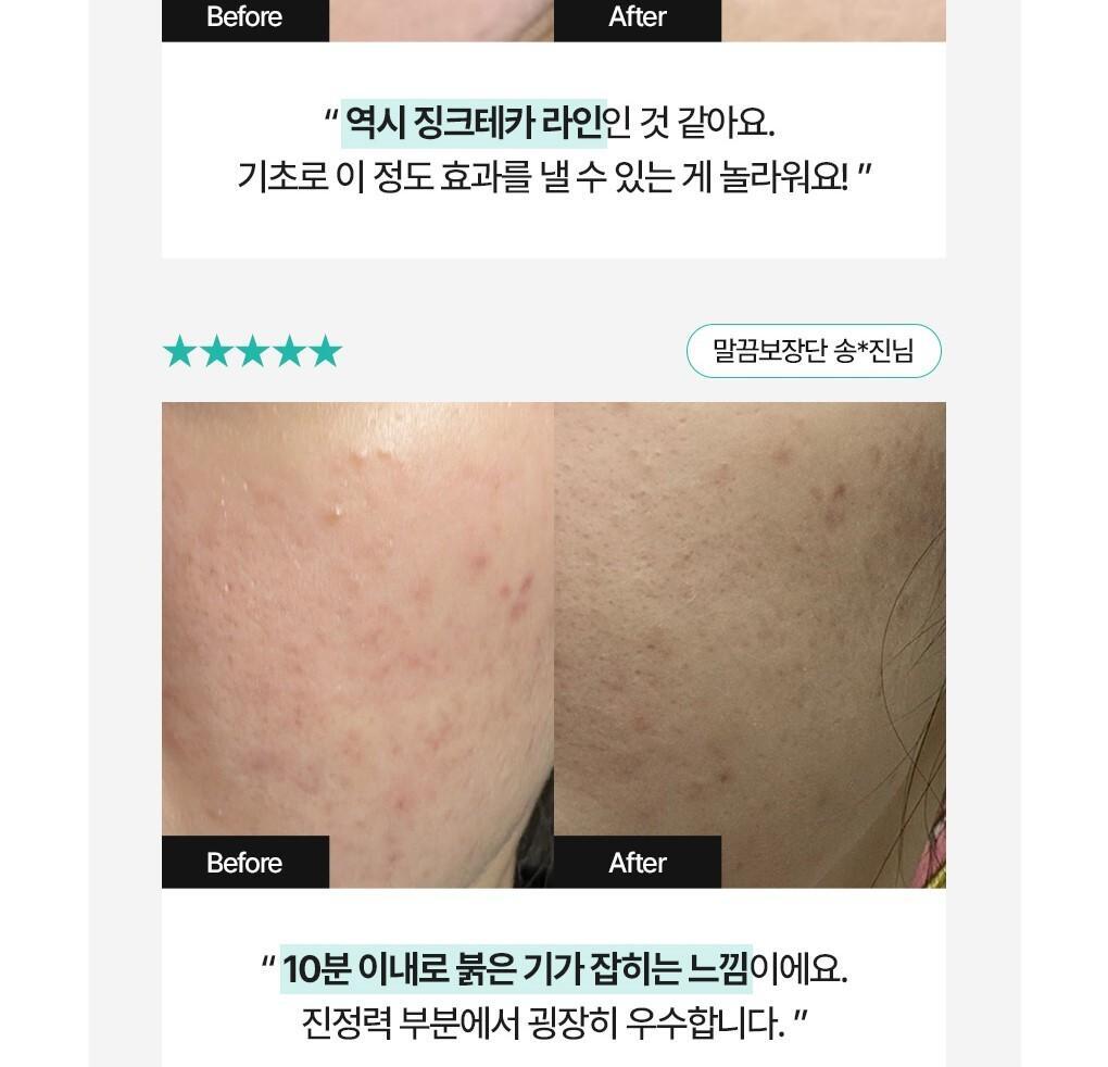 抗痘淡印~韓國 Bring Green Zinc Teca Repair Cream 鋅PCA X TECA 脂質體積雪草鎮靜修復袪痘面霜 - 80ml