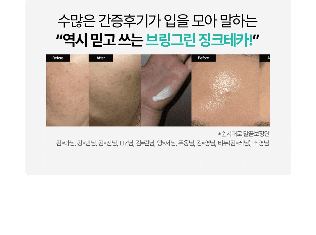 抗痘淡印~韓國 Bring Green Zinc Teca Repair Cream 鋅PCA X TECA 脂質體積雪草鎮靜修復袪痘面霜 - 80ml