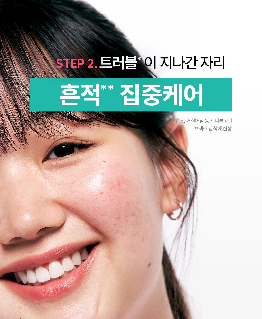 抗痘淡印~韓國 Bring Green Zinc Teca Repair Cream 鋅PCA X TECA 脂質體積雪草鎮靜修復袪痘面霜 - 80ml