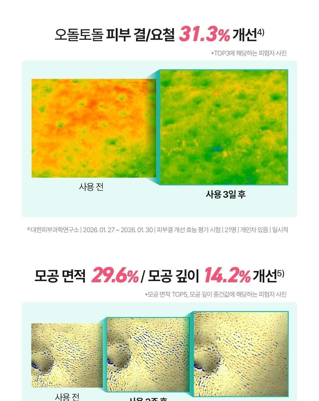 抗痘淡印~韓國 Bring Green Zinc Teca Repair Cream 鋅PCA X TECA 脂質體積雪草鎮靜修復袪痘面霜 - 80ml