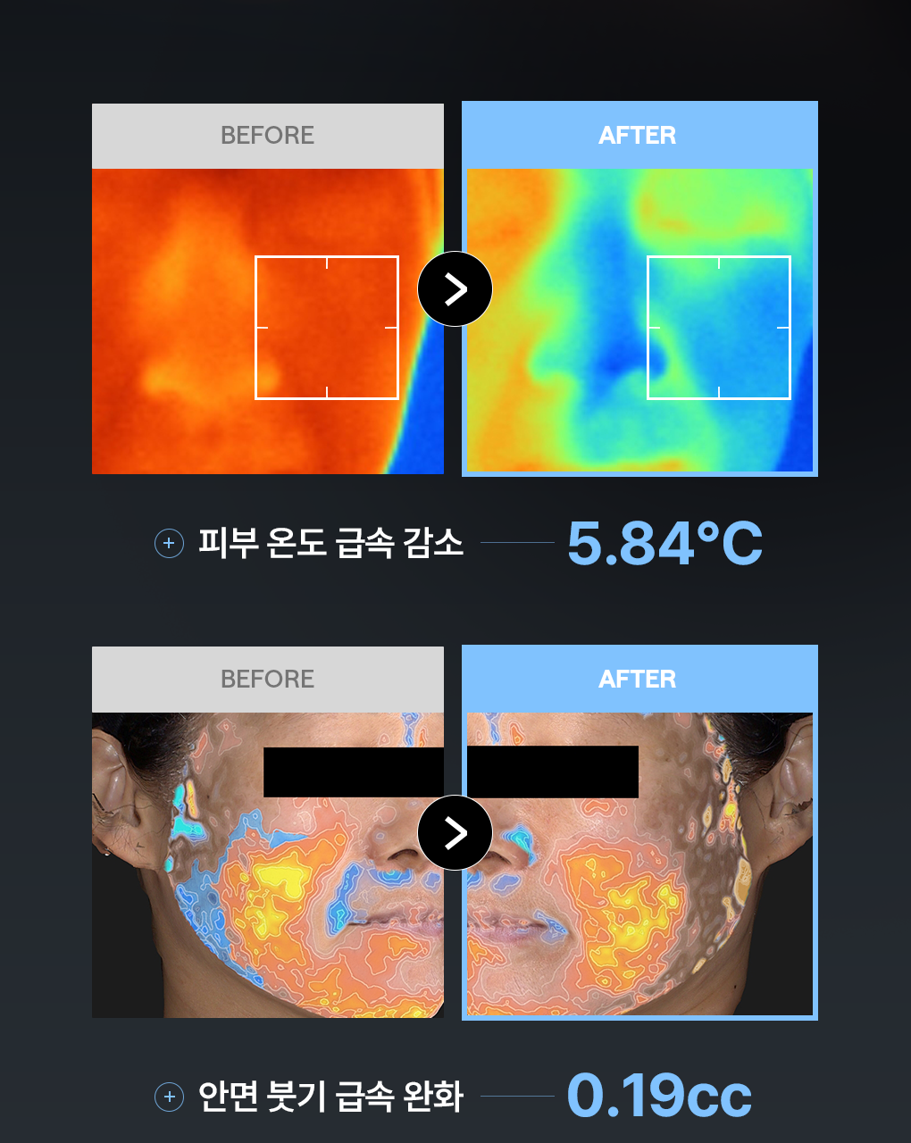【優惠Jumbo SET 1＋1 200片】30秒💧30層快速補水 韓國 Mediheal Hyaluronate Hydration Pad 99%純度低分子透明質酸深層保濕降溫爽膚棉片1＋1優惠SET