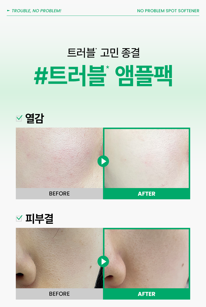 【SET送棉片】10分鐘痘痘敏感CLEAR！～韓國 ilso No Problem Spot Softener 芽萃清涼舒緩痘痘護理濕敷安瓶精華面膜水 - 150g