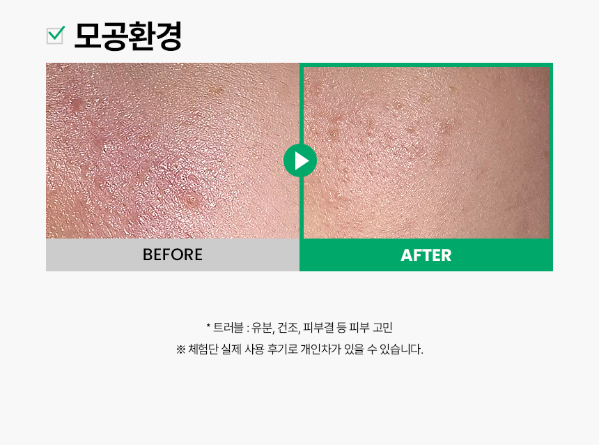【SET送棉片】10分鐘痘痘敏感CLEAR！～韓國 ilso No Problem Spot Softener 芽萃清涼舒緩痘痘護理濕敷安瓶精華面膜水 - 150g