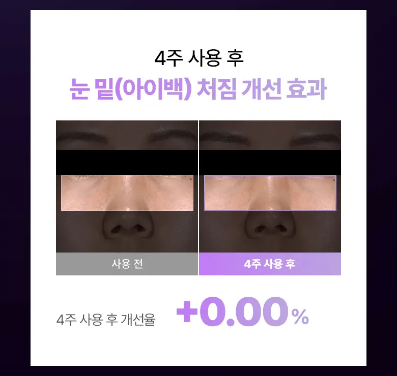 6800針微V針 KO 眼下鬆弛&皺眉紋~韓國BioHeal BOH Probioderm Collagen PDRN Eye Bag & Forehead Frown Patch 益生菌 X 膠原 X PDRN 眼下眼袋提拉與眉頭紋微針貼片 - 9片裝