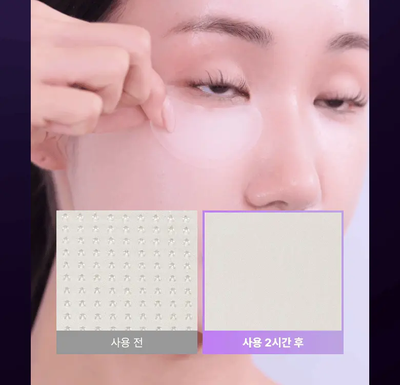 6800針微V針 KO 眼下鬆弛&皺眉紋~韓國BioHeal BOH Probioderm Collagen PDRN Eye Bag & Forehead Frown Patch 益生菌 X 膠原 X PDRN 眼下眼袋提拉與眉頭紋微針貼片 - 9片裝