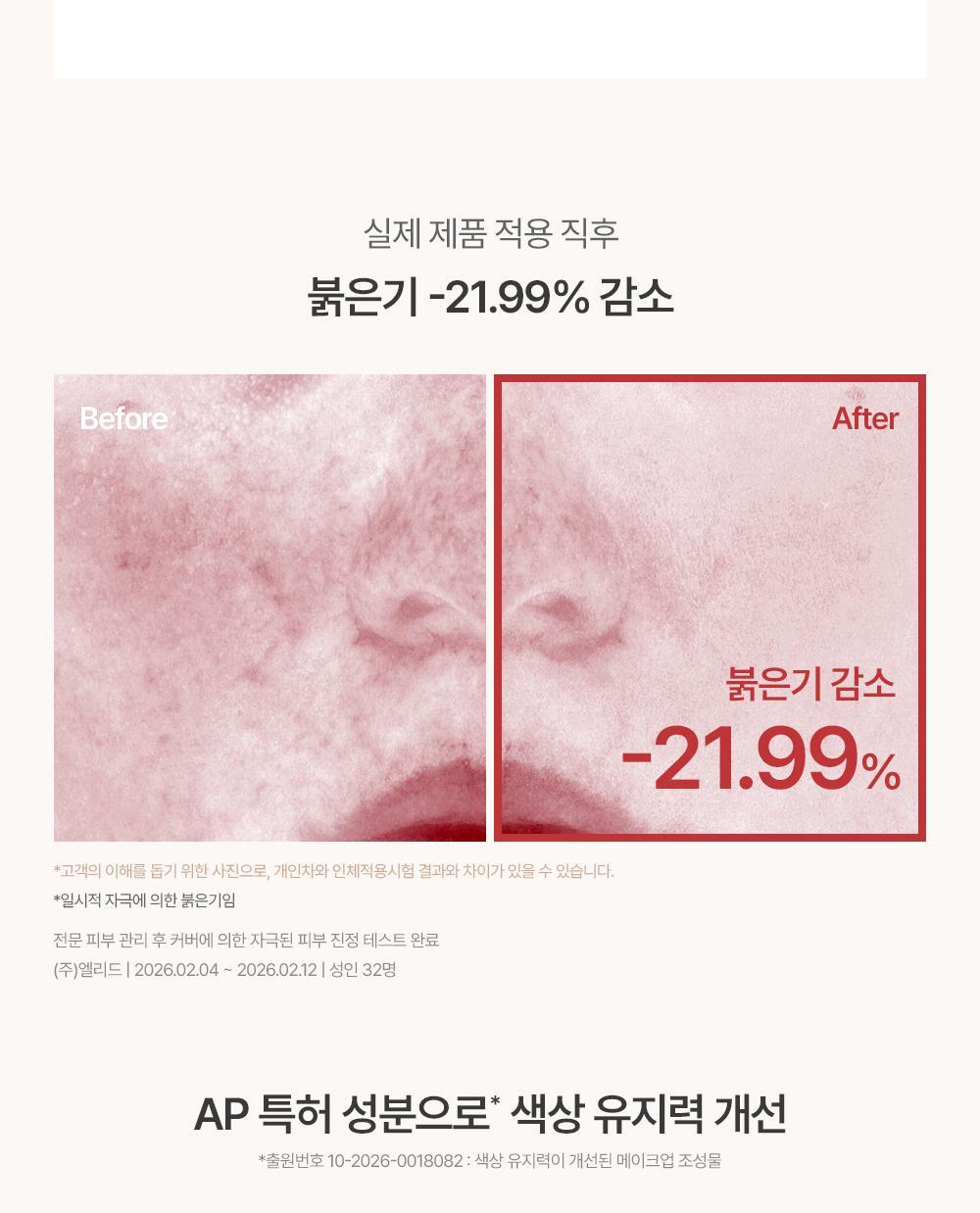 韓國espoir Derma Cover Blemish Balm 專業級修護 X 防UV X 遮瑕 BB霜 SPF50+ PA++++ - 2色選擇