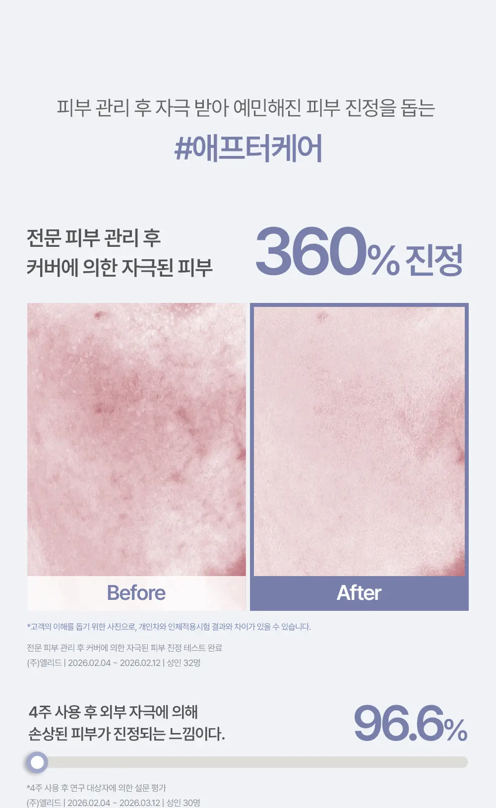 化解🏆 韓國espoir Derma Cover Blemish Balm 專業級修護 X 防UV X 遮瑕 BB霜(#01-03) SPF50+ PA++++ - 3色選擇