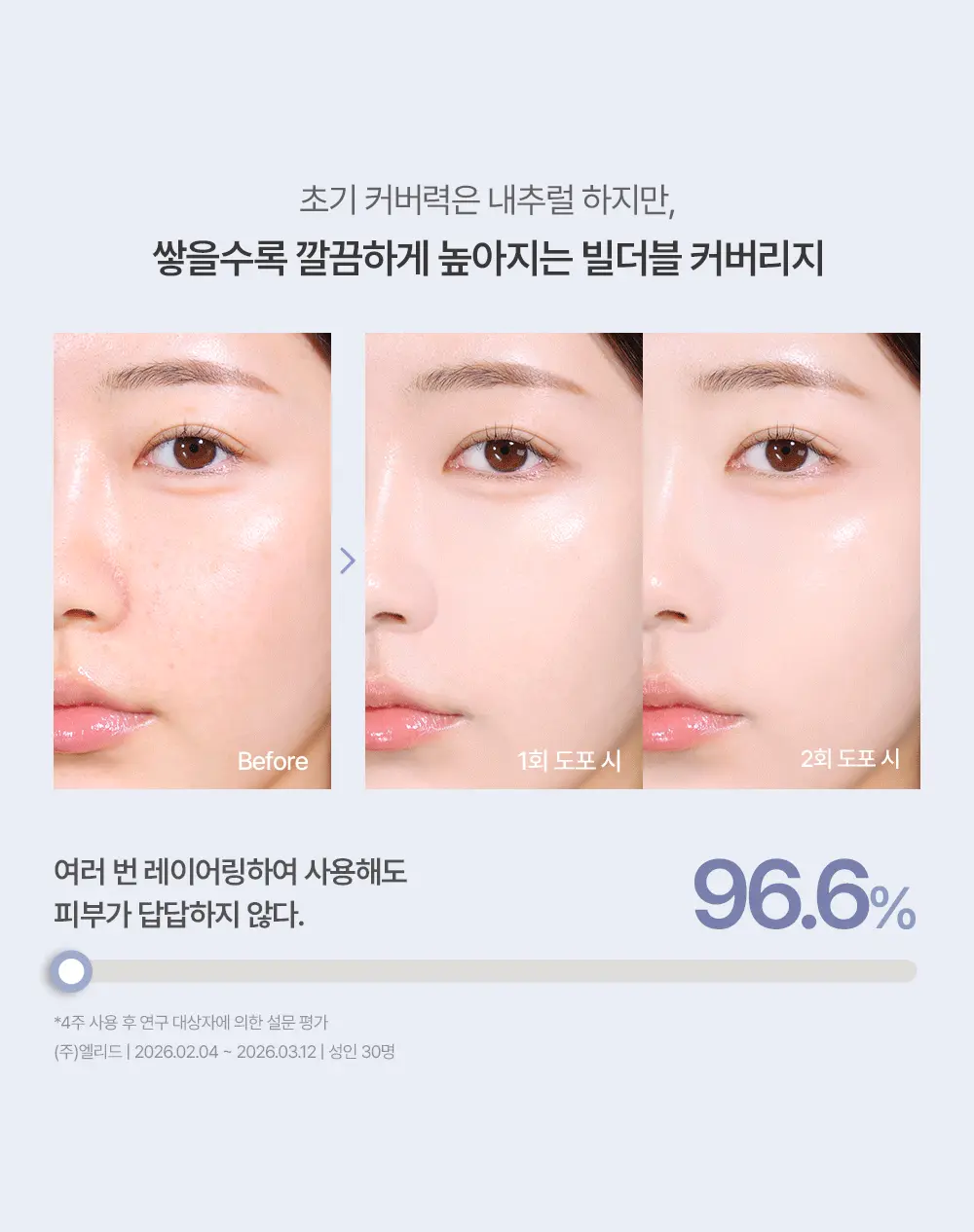 化解🏆 韓國espoir Derma Cover Blemish Balm 專業級修護 X 防UV X 遮瑕 BB霜(#01-03) SPF50+ PA++++ - 3色選擇