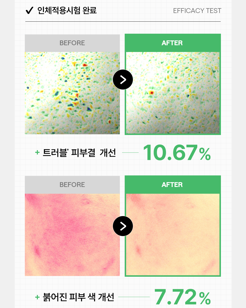 【限量1+1 Set 200片+送旅行case】粉刺暗瘡肌～🏆 韓國 MEDIHEAL Tea Tree Trouble Pad 茶樹鎮靜🌿抗炎減紅護膚棉片 - 100片