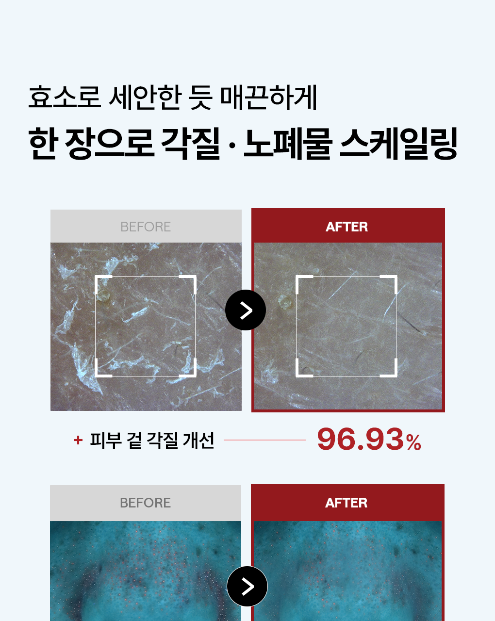 【優惠Jumbo Set 1+1 200片額外送旅行case】推介黑頭粗糙肌～韓國MediHeal Phyto-Enzyme Clear Peeling Pad 植物酵素角蛋白去角質死皮爽膚棉片 - 100片裝