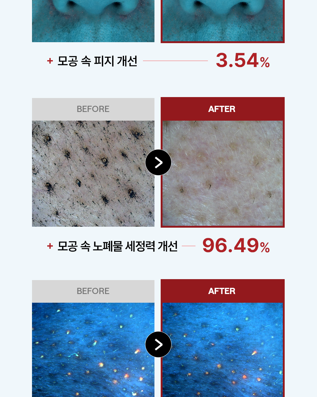 【優惠Jumbo Set 1+1 200片額外送旅行case】推介黑頭粗糙肌～韓國MediHeal Phyto-Enzyme Clear Peeling Pad 植物酵素角蛋白去角質死皮爽膚棉片 - 100片裝