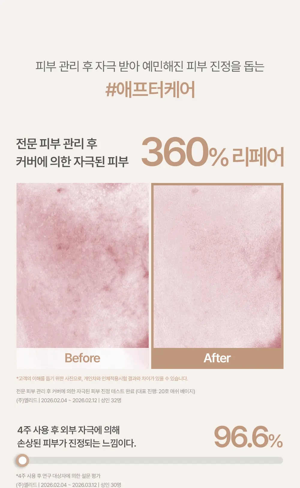 化解🏆 韓國espoir Derma Cover Blemish Balm 專業級修護 X 防UV X 遮瑕 BB霜(#01-03) SPF50+ PA++++ - 3色選擇