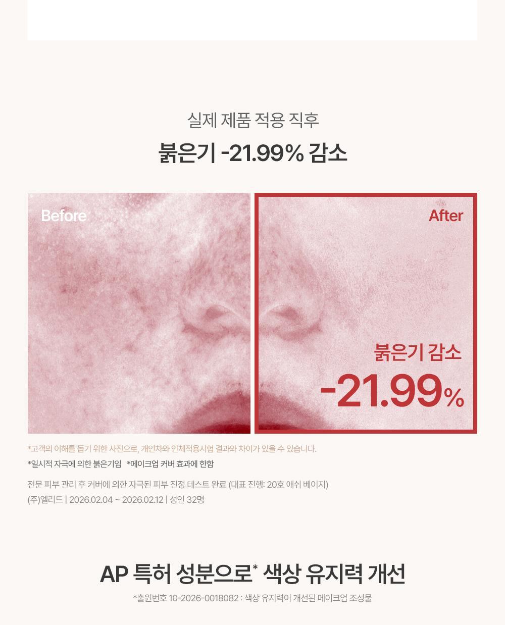 化解🏆 韓國espoir Derma Cover Blemish Balm 專業級修護 X 防UV X 遮瑕 BB霜(#01-03) SPF50+ PA++++ - 3色選擇