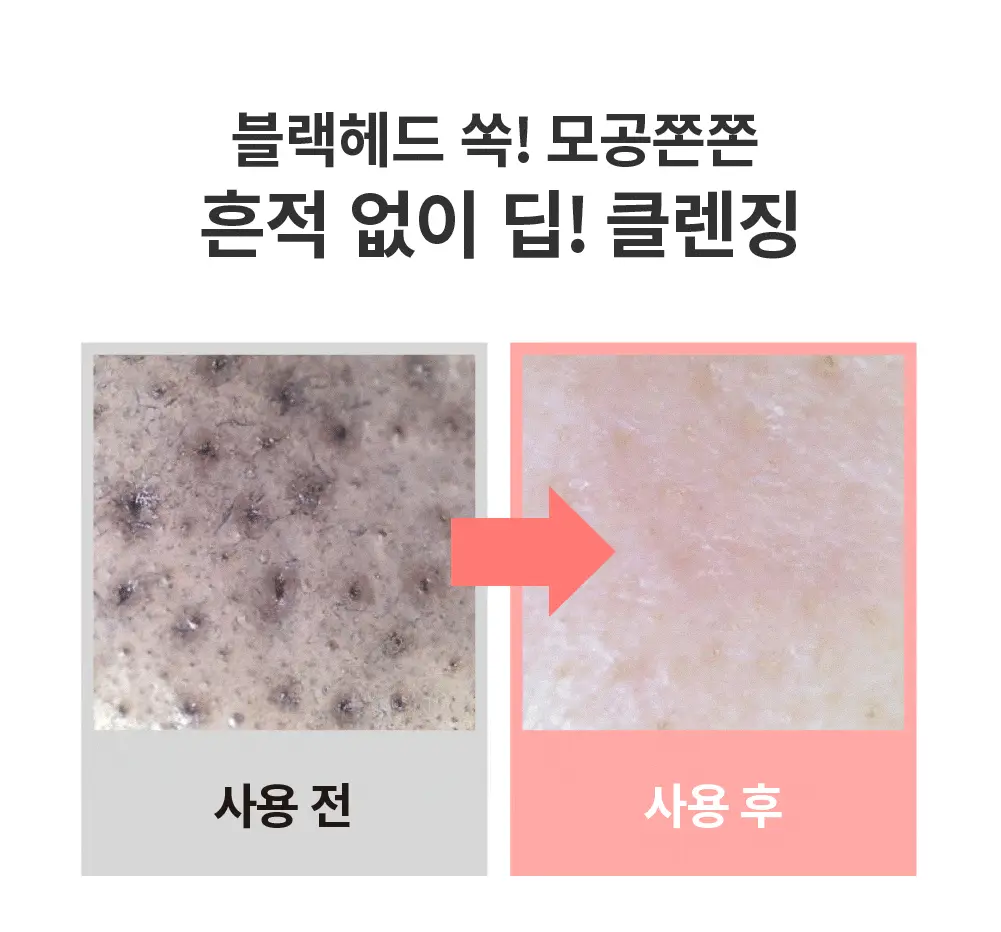 化解🏆 韓國S.NATURE Aqua Rice Cleansing Balm 米萃保濕卸妝潔面2合1潔膚膏 - 90ml