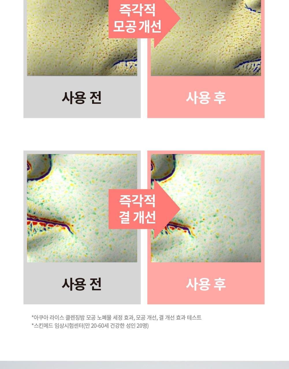 化解🏆 韓國S.NATURE Aqua Rice Cleansing Balm 米萃保濕卸妝潔面2合1潔膚膏 - 90ml