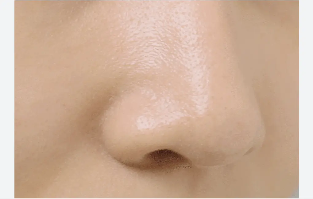 化解🏆 韓國Mediheal Blackhead Melting Clear Nose Patch 鼻頭清黑頭角質溶解清潔貼附刮刮棒 - 4片裝