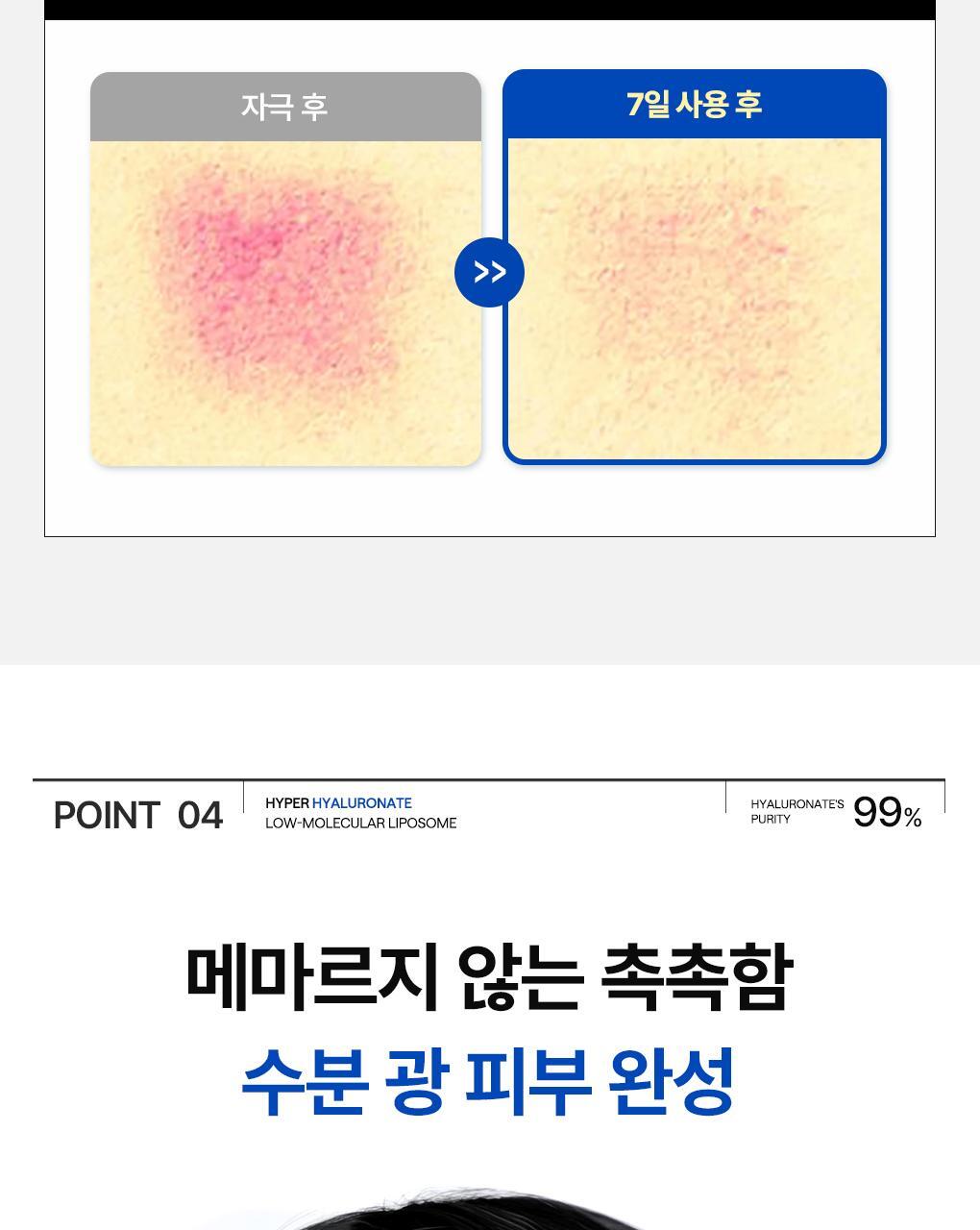 GlowPick🏆 韓國Mediheal Hyper Hyaluronate Mask (Ver.2) 高濃縮99%純透明質酸保濕凝膠果凍面膜4片裝 - 2種選擇