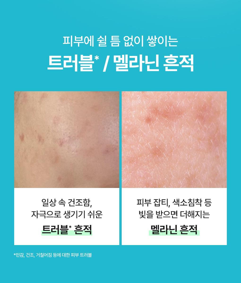 韓國Mediheal Madecassoside Wrapping Serum Mask 積雪草苷煥膚保濕淡痘印修護包裹式精華面膜 10片裝 - 2種選擇
