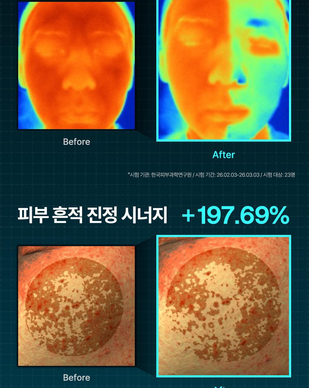 韓國Mediheal Madecassoside Wrapping Serum Mask 積雪草苷煥膚保濕淡痘印修護包裹式精華面膜 10片裝 - 2種選擇
