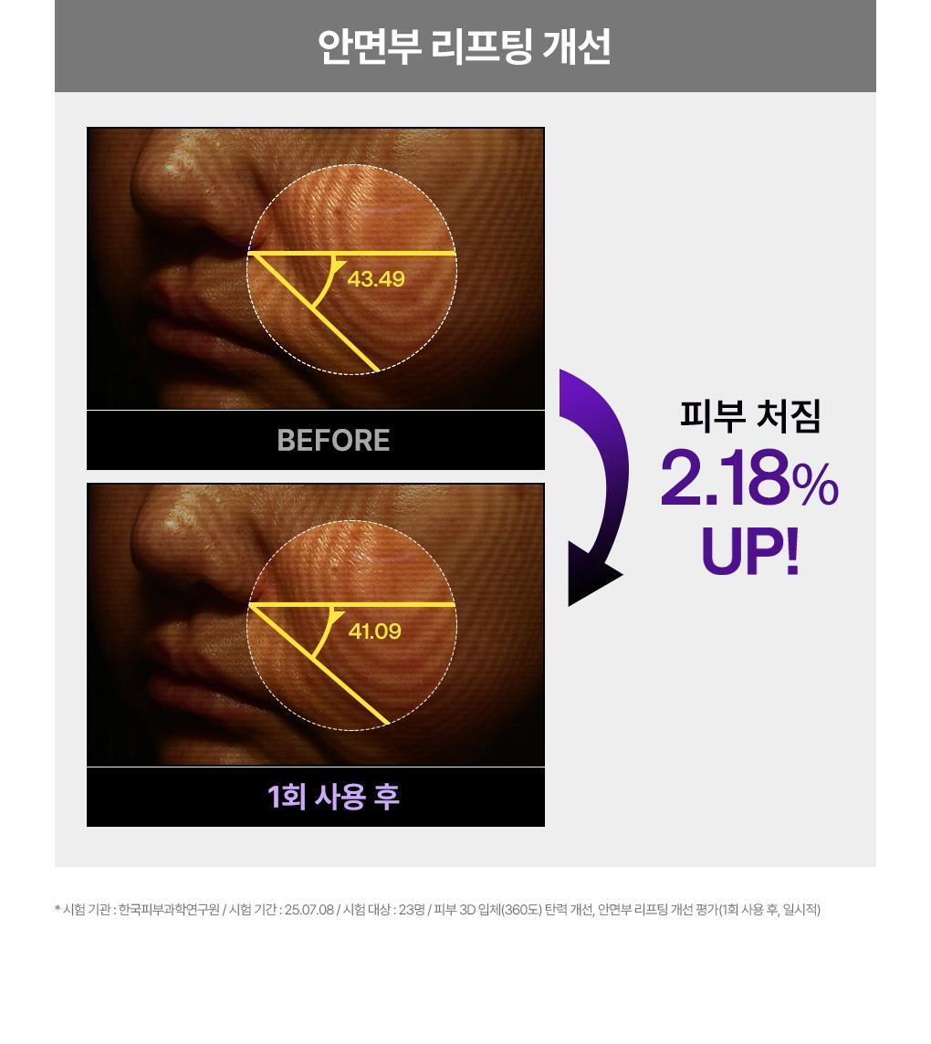 韓國 Mediheal PDRN Wrapping Serum Mask Lifting 99%純PDRN緊緻毛孔提拉包裹式精華面膜 10片裝 - 2種選擇